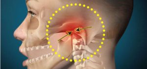 Болит челюсть возле уха основные причины симптома