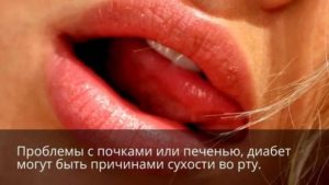 Сильно сохнет во рту ночью? Ксеростомия: причины и лечение