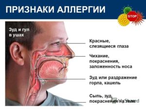 Заложенность носа при аллергии, ее причины, симптомы и лечение
