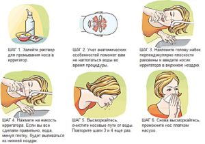 Что делать, если насморк не проходит: эффективные методы лечения