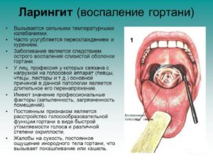 Основные симптомы ларингита и фарингита