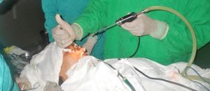 Трепанопункция лобной пазухи эффективный хирургический метод лечения фронтита