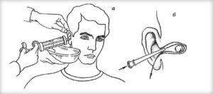 Что делать, если при промывании носа вода попала в ухо?