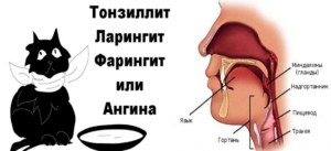 Боль в горле: основные причины и лечение