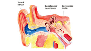 Как выгнать воду из уха: удаление воды из полости уха