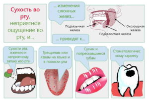 Сильно сохнет во рту ночью? Ксеростомия: причины и лечение