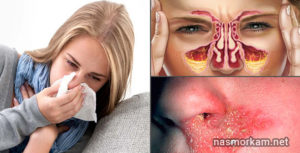 Болит внутри носа? Ищем причину