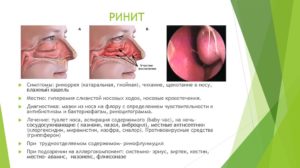 Ринит что это: виды, формы, лечение и осложнения