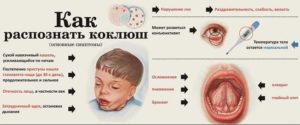 Кашель у ребенка без температуры и соплей причины, лечение и профилактика