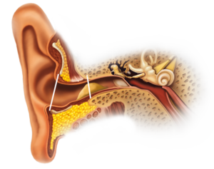 Ушная пробка: виды, симптомы и методы удаления