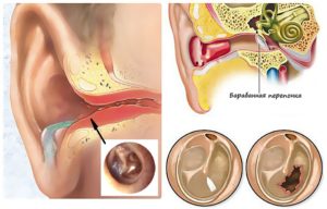 Болит ухо внутри: причины и что делать