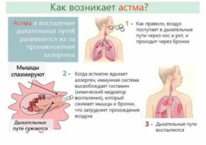 О чем говорит сильный кашель без температуры у взрослого и как его лечить?