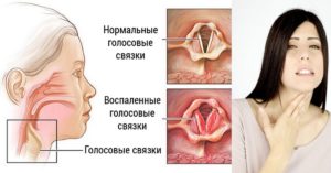 Чешется горло изнутри: причины, опасные признаки и методы лечения