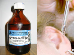 Как правильно почистить уши перекисью водорода