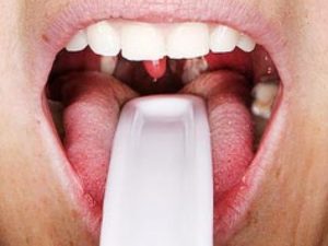 Ожог слизистой горла: медикаментозное и народное лечение