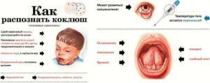 Коклюш у взрослых: признаки, лечение и возможные осложнения