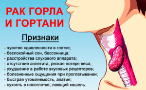 Виды заболеваний гортани, их симптомы и лечение