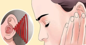 Тиннитус звон в ушах: причины и лечение