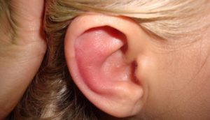 Воспаление уха – отит: признаки у детей и взрослых