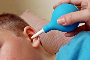Как правильно промыть уши в домашних условиях?
