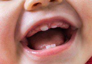 Что делать, если у ребенка появился кашель при прорезывании зубов?
