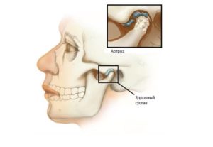 Болит челюсть возле уха основные причины симптома