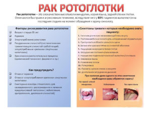 Рак ротоглотки: все о патологии