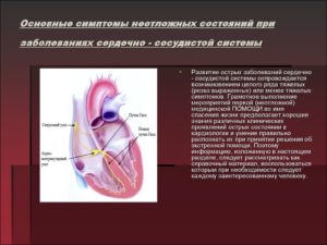 Появление сердечного кашля как признак заболевания сердечно-сосудистой системы