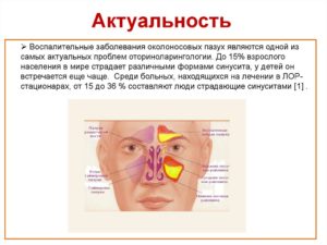 Гайморовы пазухи эффективное лечение воспаления