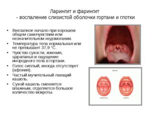 Виды заболеваний гортани, их симптомы и лечение