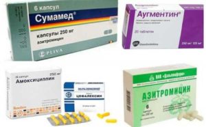 Антибиотик при болях в горле: обзор лучших препаратов