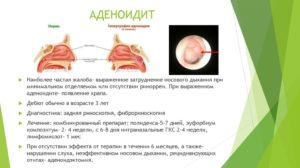 Консервативное лечение аденоидов у детей: симптомы болезни и основные принципы лечения