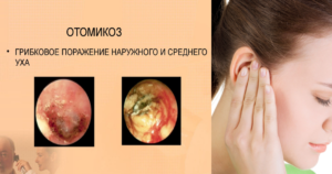 Чешется ухо внутри: причины, характерные симптомы и способы лечения