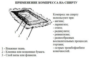 Компрессы для горла: рецепты и правила