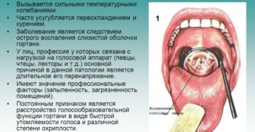 Заболевание гортани: основные симптомы и причины