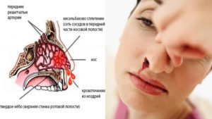 Сухая слизистая носа: причины и лечение