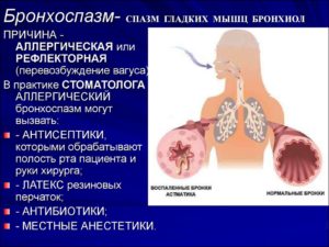 Бронхоспазм что это такое и чем он опасен?