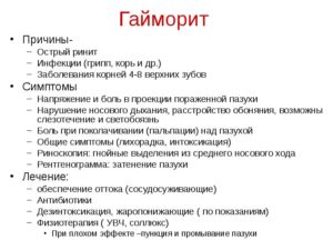 Синусит у детей: причины, симптомы и лечение заболевания