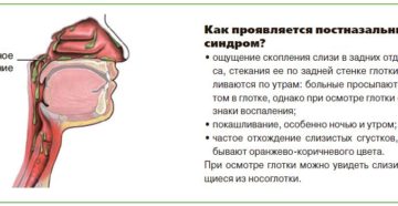 Слизь из носа стекает в горло постназальный синдром: причины и лечение