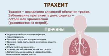 Симптомы трахеита и эффективные методы лечения болезни