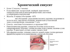 Воспаление носовых пазух: традиционные и нетрадиционные методы лечения