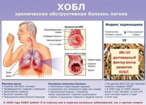 Болезни легких: классификация и первые признаки