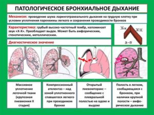 Свистящее дыхание: физиологические и патологические причины