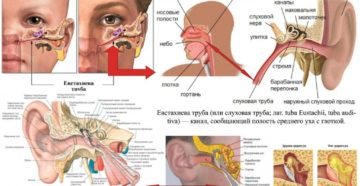 Что делать, если при промывании носа вода попала в ухо?