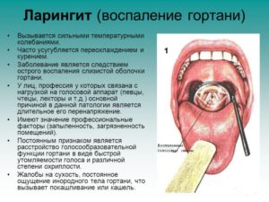 Виды заболеваний гортани, их симптомы и лечение