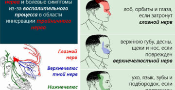 Тройничный лицевой нерв: симптомы, причины воспаления и лечение народными средствами