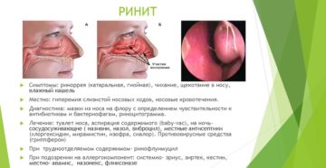 Лечение отека слизистой носа у грудничков, взрослых и при беременности