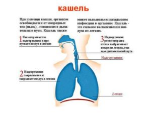 Почему возникает сухой лающий кашель у ребенка и чем его лечить?