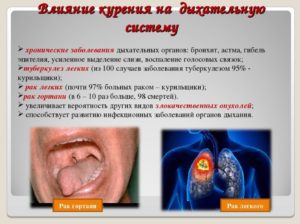 Можно ли курить, когда болит горло вред табачного дыма на слизистую горла