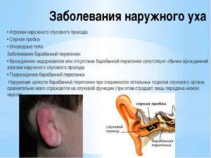 При каких заболеваниях давит на уши изнутри симптомы, причины, лечение